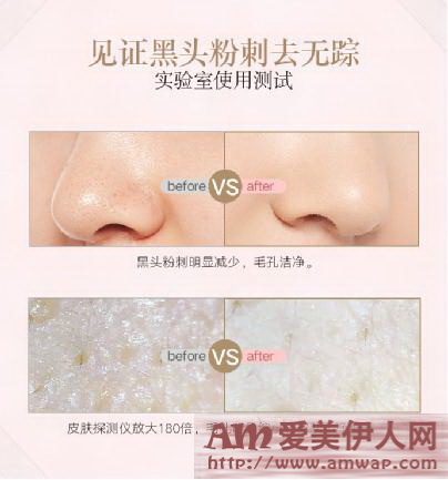 科学对抗PM2.5，温和去黑头粉刺神器 雅萌(YA-MAN)超声波毛孔清洁美容仪全新上市
